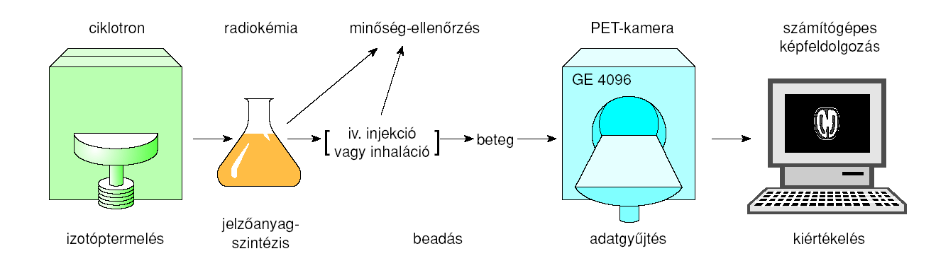 PET feltételei PET készülék (~1milliárd Ft) Ciklotron (részecskegyorsító) az izotópok