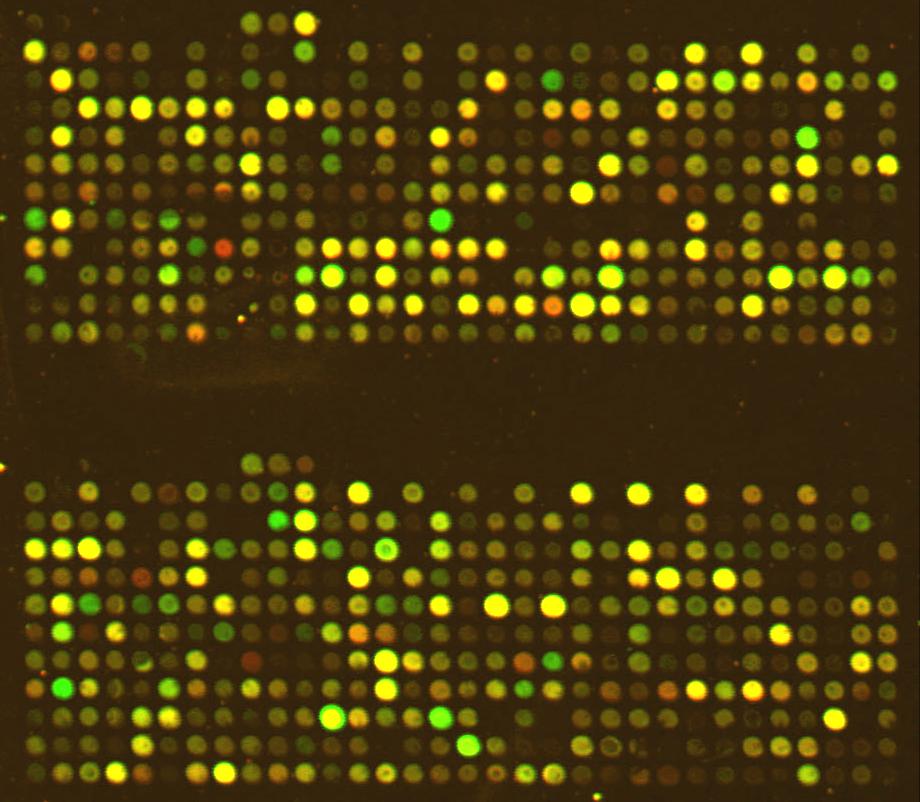 DNS-chipek alkalmazásai: (1) szövetspecifikus génexpresszió különbségek vizsgálata RNS