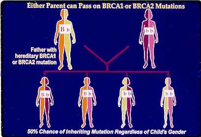 Új feladatok - BRCA (breast cancer) 1, 2 gén mutáció BRCA-1 gén mutáció: - emlőrák kockázata 70-80% - petefészekrák kockázata 25-40% BRCA-2 gén mutáció: - női-férfi emlőrák Emlőrák családi