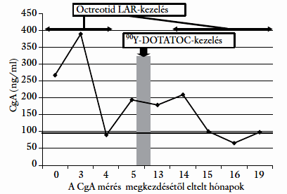 A CgA szérumszintjének változása hormonálisan