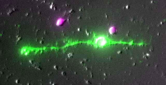 Müller glia Summary of Muller Glia Specific and Enriched Genes - retina fejlődésében kulcsszerep - axonnövekedés, szinaptogenezis