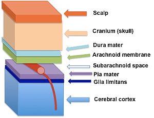 leptomeningeal cell from the pia mater (N - nucleus) Scale