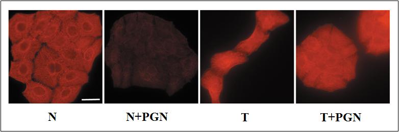 A. B. C. D. E. F. G. 12. ábra A mir-203 targetfehérjéinek - p63 és SOCS3 - génexpressziós mintázata (A) keratinocitákban akut és perzisztens gyulladásos modellben.