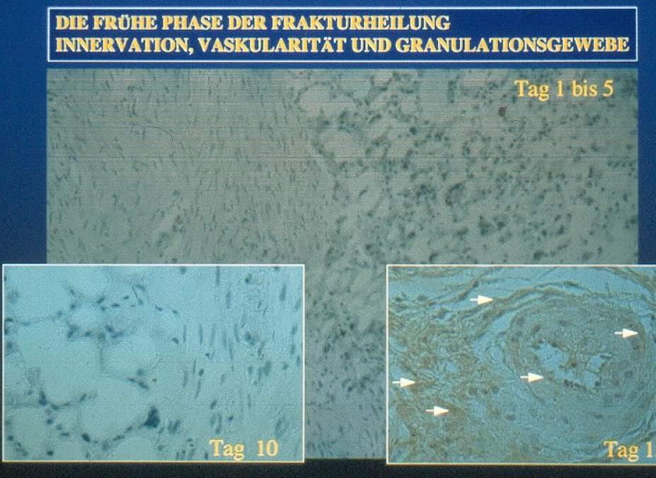 I. 1. fibroblasztok 2, idegrostok és