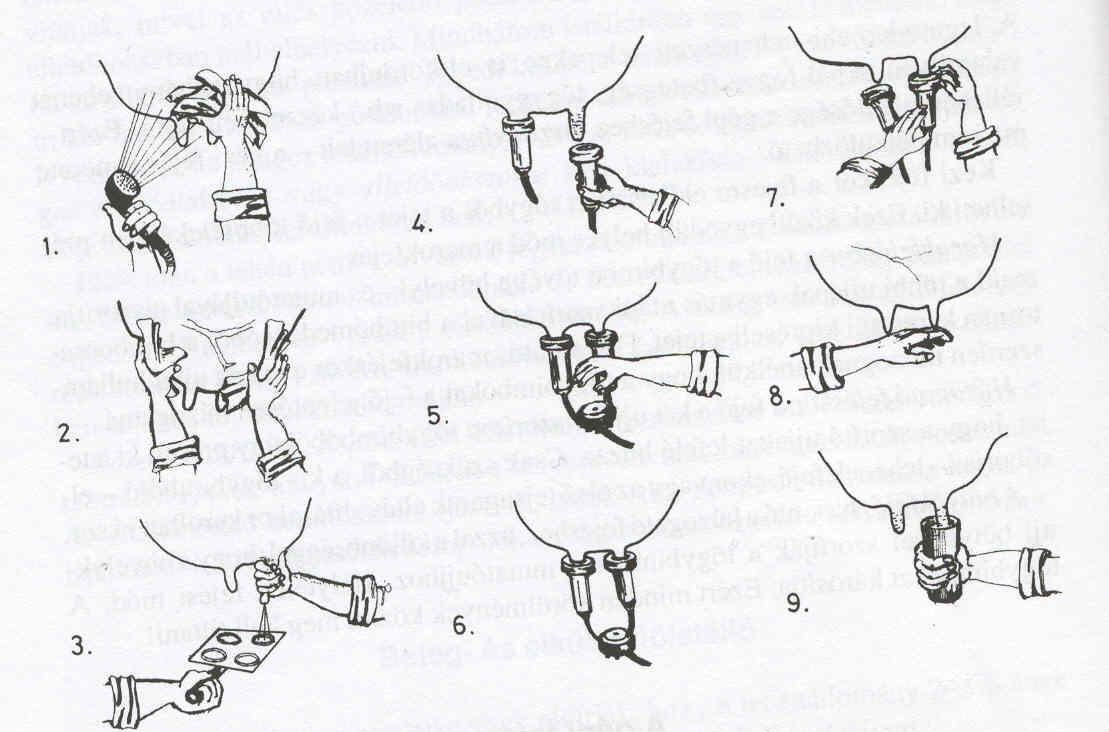 Tőgy előkészítése: 1. Tőgymosás (35-40 C o -os vízzel) 2. Tőgytörlés és masszálás 3. Első tejsugarak kifejése Gépi fejés 4. Fejőkelyhek felhelyezése 5.