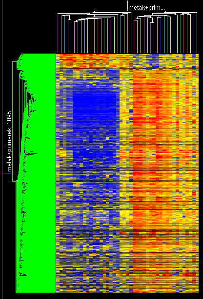 Megfigyeltük, hogy a metasztázisok (dendogrammon lila színnel jelölve) közül négy génexpressziós mintázata szoros kapcsolatban áll a rossz prognózisú primer melanomák mintázatával, mind a négy