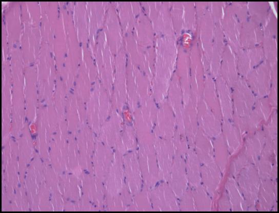 femoralis v.