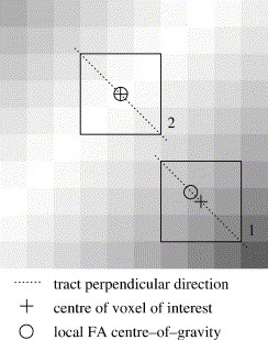 TBSS: tract-based spatial statistics (Jakab András), gráfok Agyi hálózatok végpontjai Funkcionális agyi hálózatok élei Strukturális agyi hálózatok élei Alapelv: nem a teljes agy képének voxelszintű