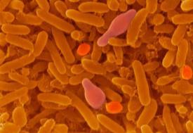 lipázok, proteázok) A hűtve tárolt hús romlása során számos mikroba jelen van Baktériumok Élesztőgombák Azonosított élesztőgomba fajok Candida zeylanoides Rhodotorula
