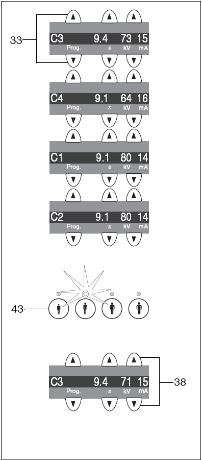 7 Kefalometriás felvételek (Ceph) 7 Kefalometriás felvételek (Ceph) 7.