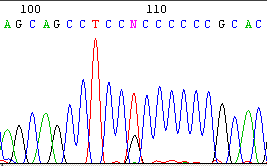 EGFR G 216T polymorphism Normal