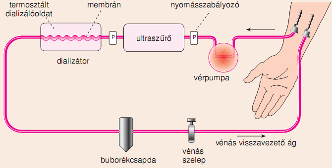 1. Dialízis Diffúzió és az ozmózis szerepe, felhasználása A dialízis lényege a veseműködés mesterséges pótlása.