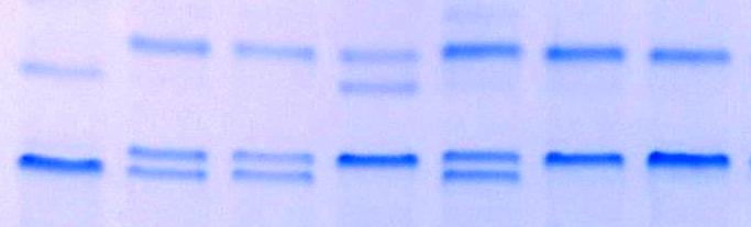 ábra) PCR GG GG AG GG GG GG termék -238 MspI -308 NcoI 134 bp 152 bp 202 bp 220 bp AG AG GG AG GG GG 9.