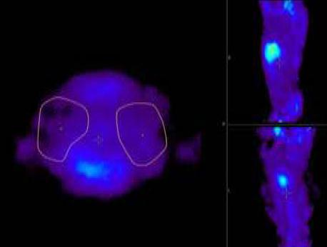 Miért éppen a PAF? Penicillium chrysogenum termeli. Antifungális aktivitás mm koncentrációban. Aspergillosis elleni terápia?