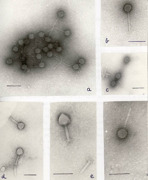 28 C. difficile izolátum 15 toxintermelő 13 toxin negatív 18 törzs bizonyult lizogénnek, ép és