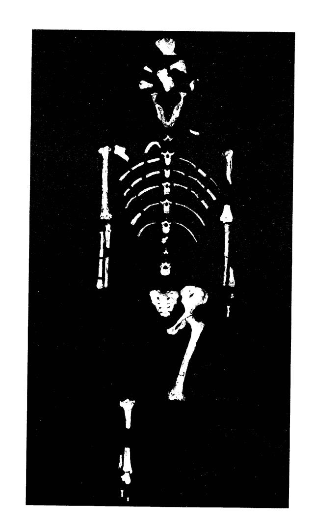2.3. ábra: Lucy. Ezt a népszerű nevén Lucyként ismert fosszilis leletet Maurice Taieb, Donald Johanson és munkatársai fedezték fel 1974-ben Etiópiában.
