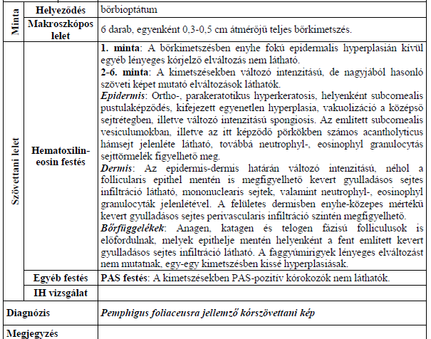 Vérvizsgálat Enyhe hypochrom microcyter anaemia, fiziológiás máj-, hasnyálmirigy-, vesefunkciós értékek és metabolikus paraméterek Szövettani lelet Subcorneális pustula acantholyticus sejtekkel,