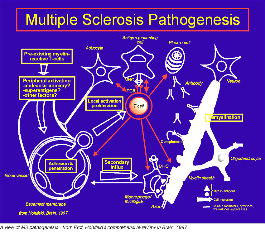 I D E G R E N D S Z E R SCLEROSIS MULTIPLEX DEFINITIO: Myelinhüvely gyulladással, axon és neuron pusztulással járó, progrediáló központi idegrendszeri megbetegedés. EPIDEMIOLÓGIAI: 37.