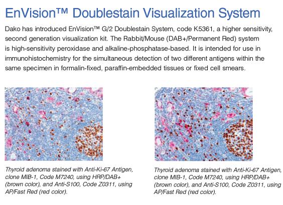 Automatizált kettős jelölés EnVision Doublestain System