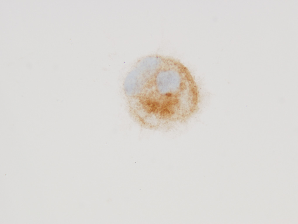 fluoreszcens immuncitokémia és Western blot módszereket használva azt találtuk, hogy claudin-1 pozitívak a HuH7, PLC, HepG2, Hep3B, T47D, HT29, HeLa; valamint claudin-4