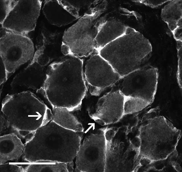 Szatellitasejtek Satellite glial cells (SGCs) Érző neuron SGC unit. A: egér DRG, SGC sejtek neuronok körül. A neuron- SGC egységeket kötőszövet (ct) választja el.