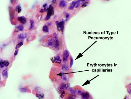 pneumociták: 2-es típusú alveoláris sejt: alveolusok falában az 1-es típusok között található kubidiális sejtek, 1-es típussá