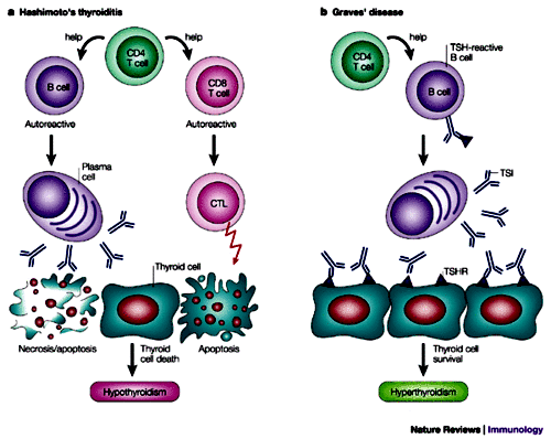 Hashimoto thyreoiditis Graves Basedow kór Necrosis és
