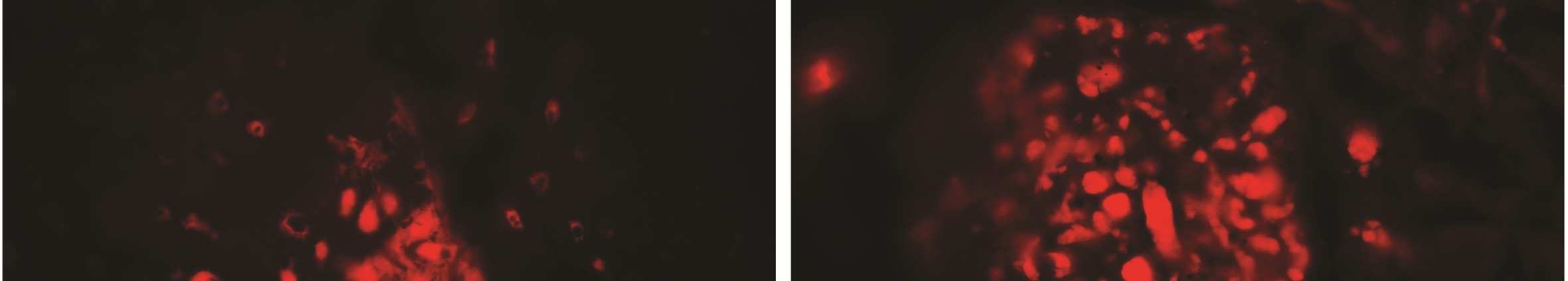 35. ábra A RAAS immunfluoreszcens bemutatása csontspecifikus kontrollokban és humán vesemintákban. A1: A kortikális csont normál struktúrájú cement vonalakat és ereket ábrázol (HE, jobb fül).