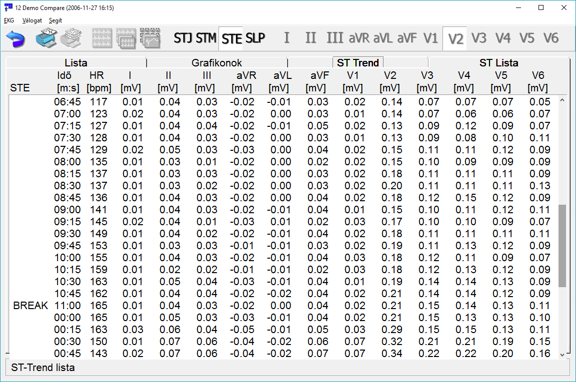 ST-Lista Táblázat, mely a szívfrekvencia és a standard 12 csatorna ST adatait foglalja össze. Az STE, STJ, STM illetve SLP értékek a megfelelő gomb megnyomásával vagy [F5]-tel válthatók.