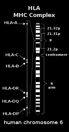Etiológia DR15 és DQ6 és az ehhez kapcsolódó genotípusok DRB1*1501,