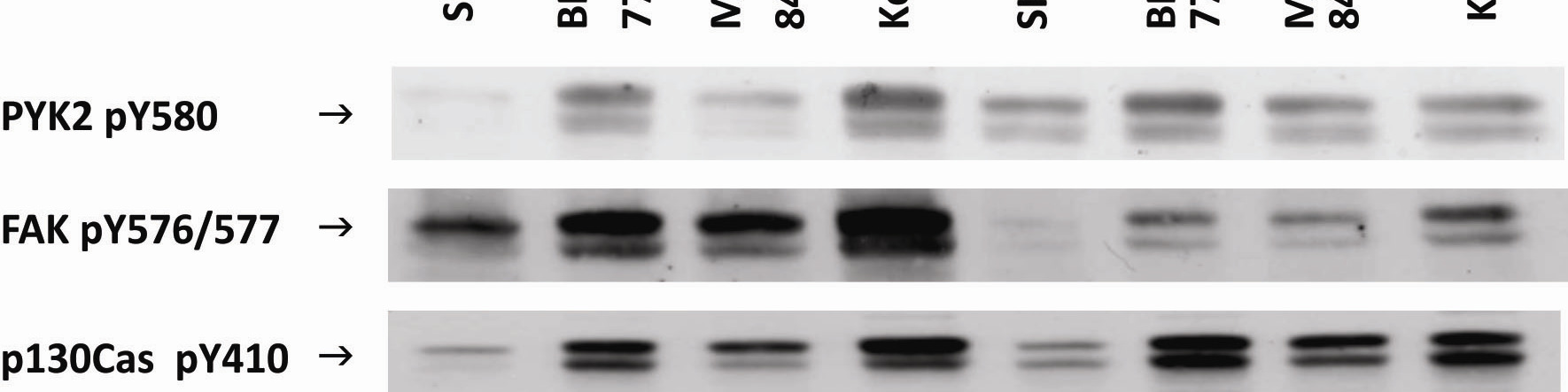 8. ábra. Az AXL tirozin kináz inhibitorok migrációs kinázokra gyakorolt hatása. Az MDA-MB-231 sejtvonalat 1,5 vagy 48 óráig kezeltük 1 µm MPCD84111-el, SKI606-al vagy BMS777607-el.