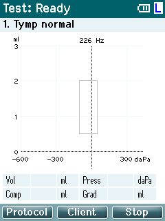 Titan használati útmutató HU Page 38 3.5 A Titan használata kézi üzemmódban 3.5.1 Indítás A Titan indításkor mindig a legutoljára használt protokoll vizsgálati képernyőjét jeleníti meg, és azonnal készen áll a mérés indítására.