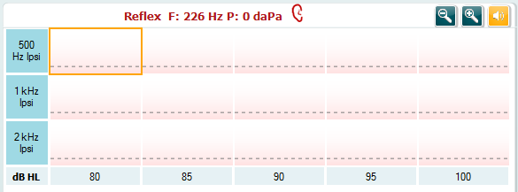 Titan használati útmutató HU Page 64 A Manual stimulus (Manuális stimulus) gomb akkor válik aktívvá, ha manuális vizsgálatot választ ki egy reflex vizsgálatban.