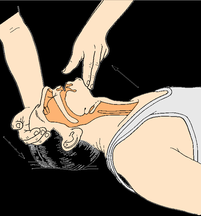 Basic Life Support Átjárható légutak (Szájüreg