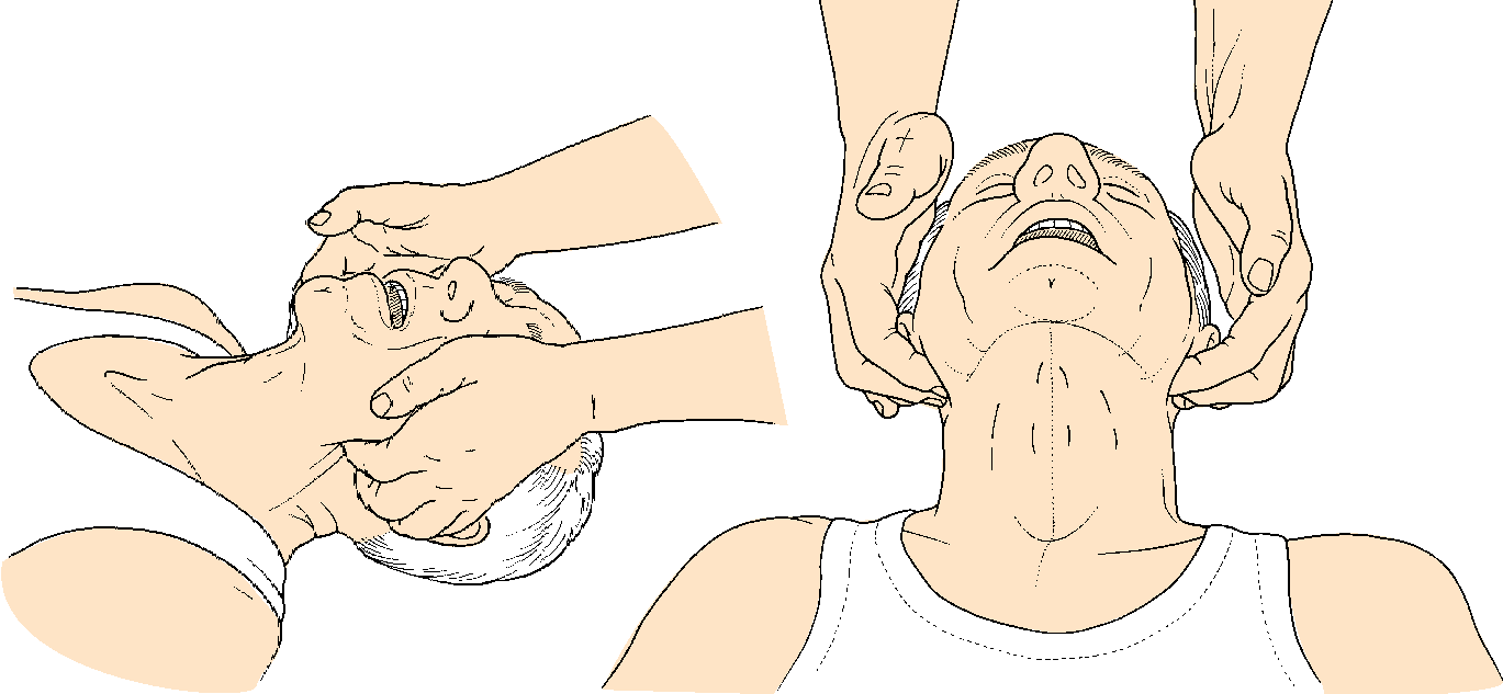 Basic Life Support