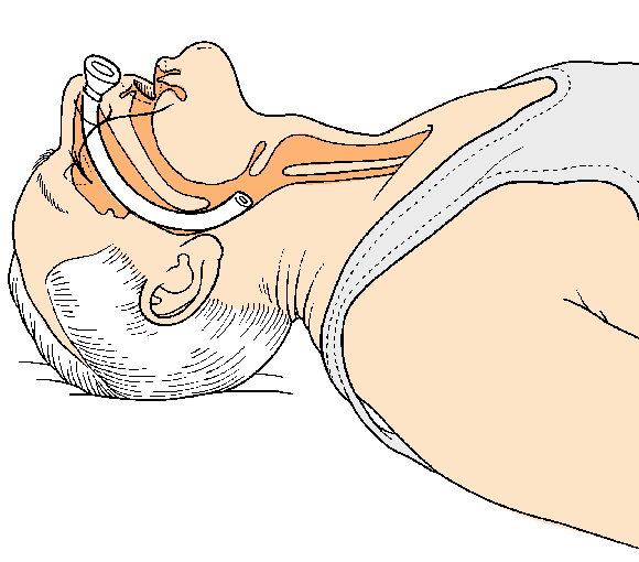 Basic/Advanced Life Support