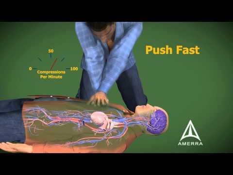 Basic Life Support Keringés