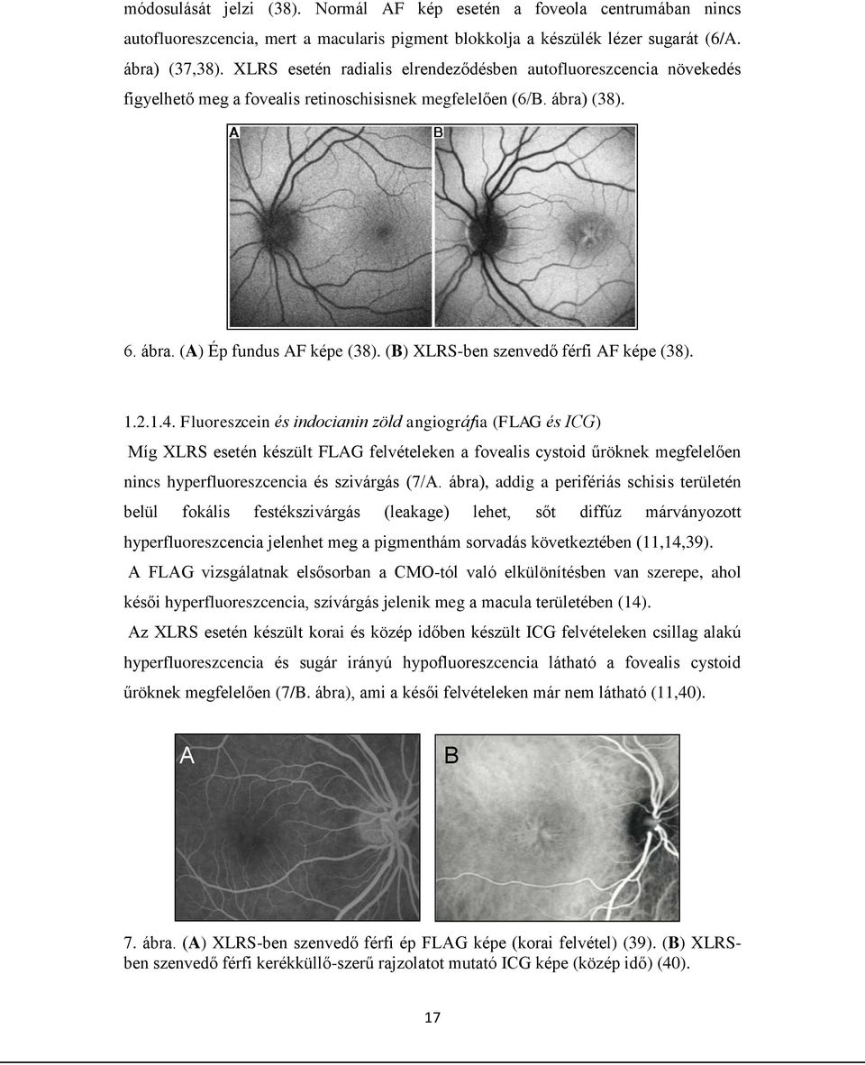 (B) XLRS-ben szenvedő férfi AF képe (38). 1.2.1.4.