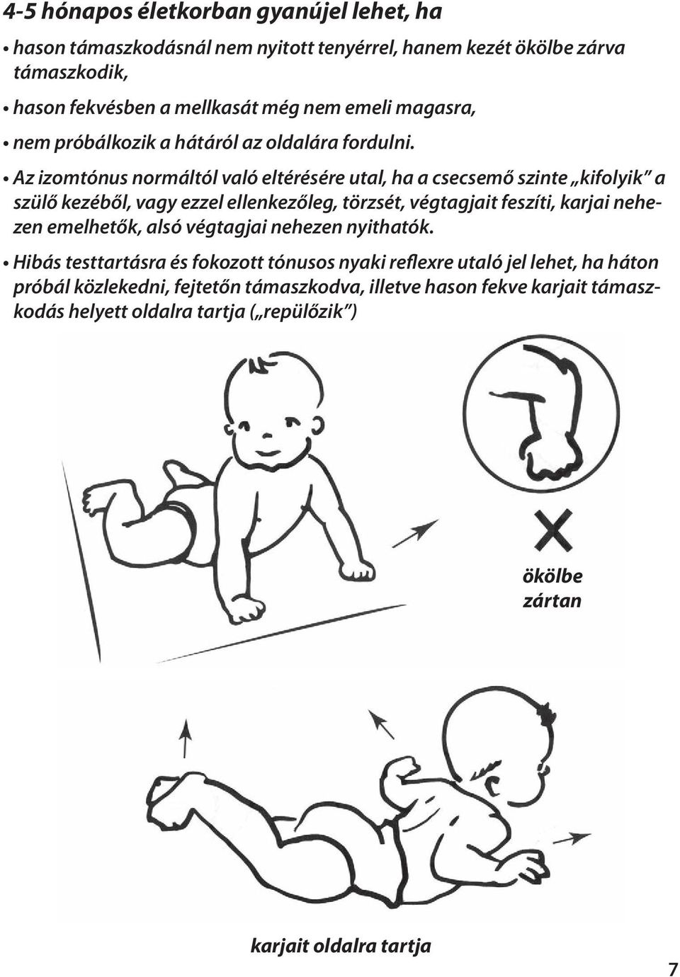 Az izomtónus normáltól való eltérésére utal, ha a csecsemő szinte kifolyik a szülő kezéből, vagy ezzel ellenkezőleg, törzsét, végtagjait feszíti, karjai nehezen