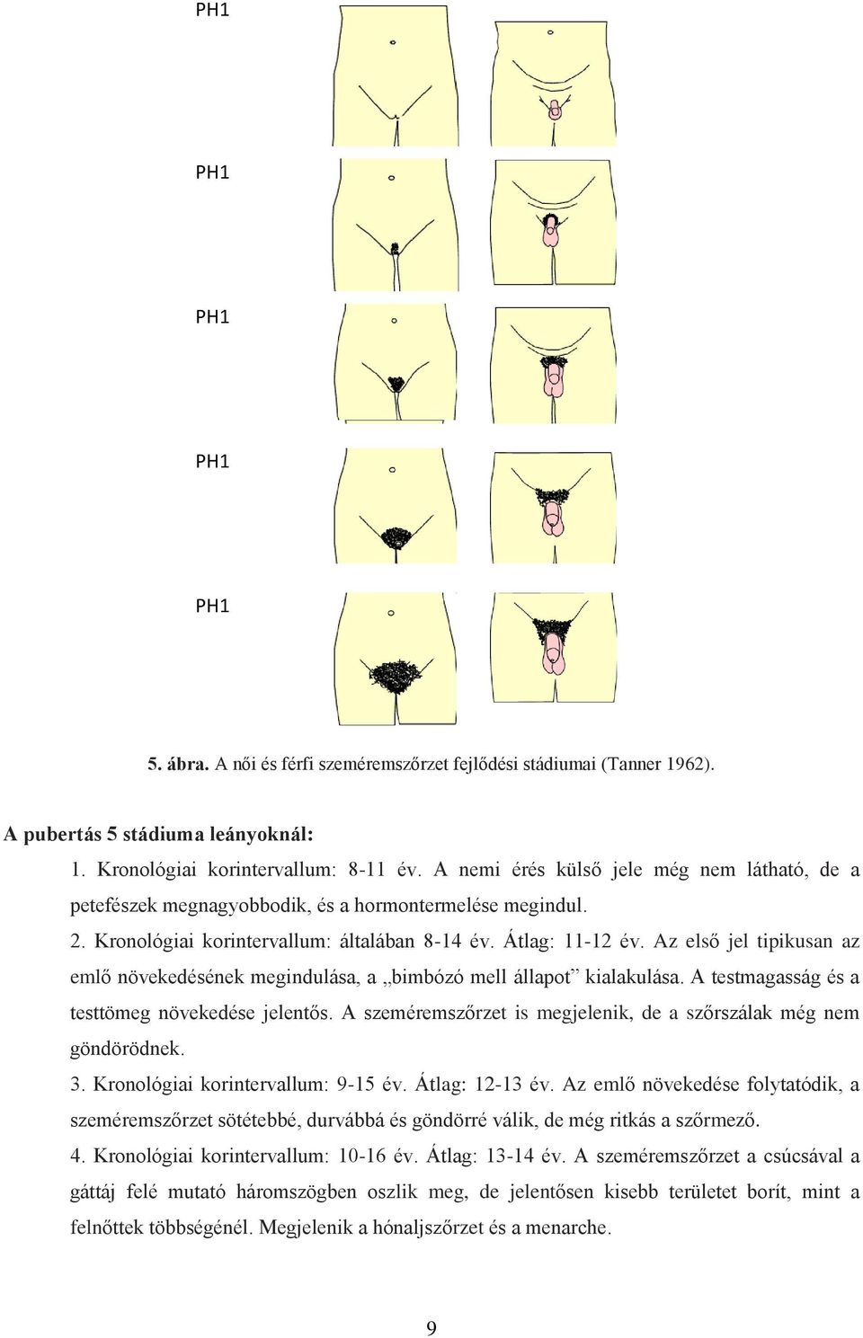 szőrzet a hasbőr pehelyszőrzetével megegyező. PH1 2. stádium (PH2): Ritkás, vékony, egyenes szőrszálak, 2. stádium (PH2): általában Ritkás, a nagyajkak vékony, egyenes felszínén, ill. szőrszálak, 2. stádium penis tövén (PH2): általában Ritkás, a nagyajkak vékony, egyenes felszínén, ill.