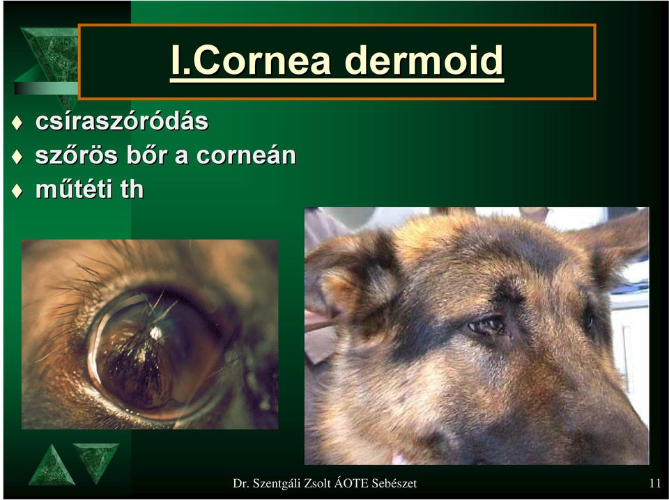 th I.Cornea dermoid Dr.
