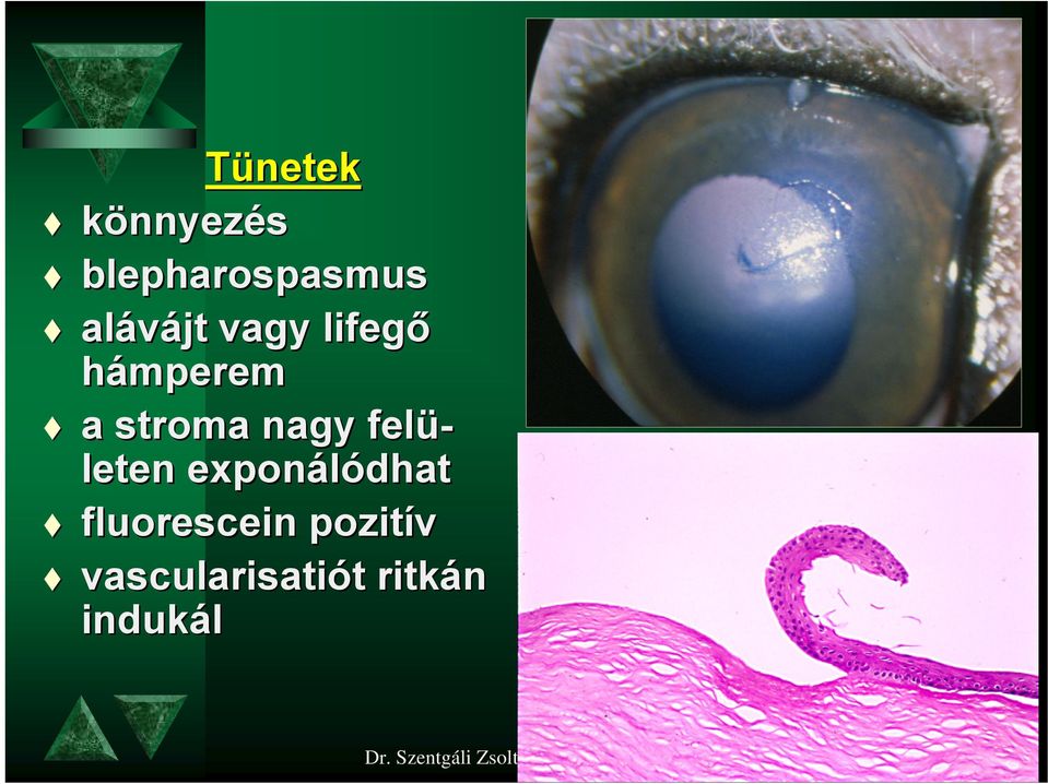 exponálódhat fluorescein pozitív