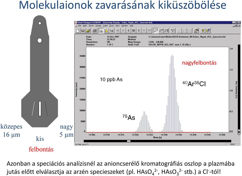 anioncserélő kromatográfiás oszlop a plazmába jutás előtt