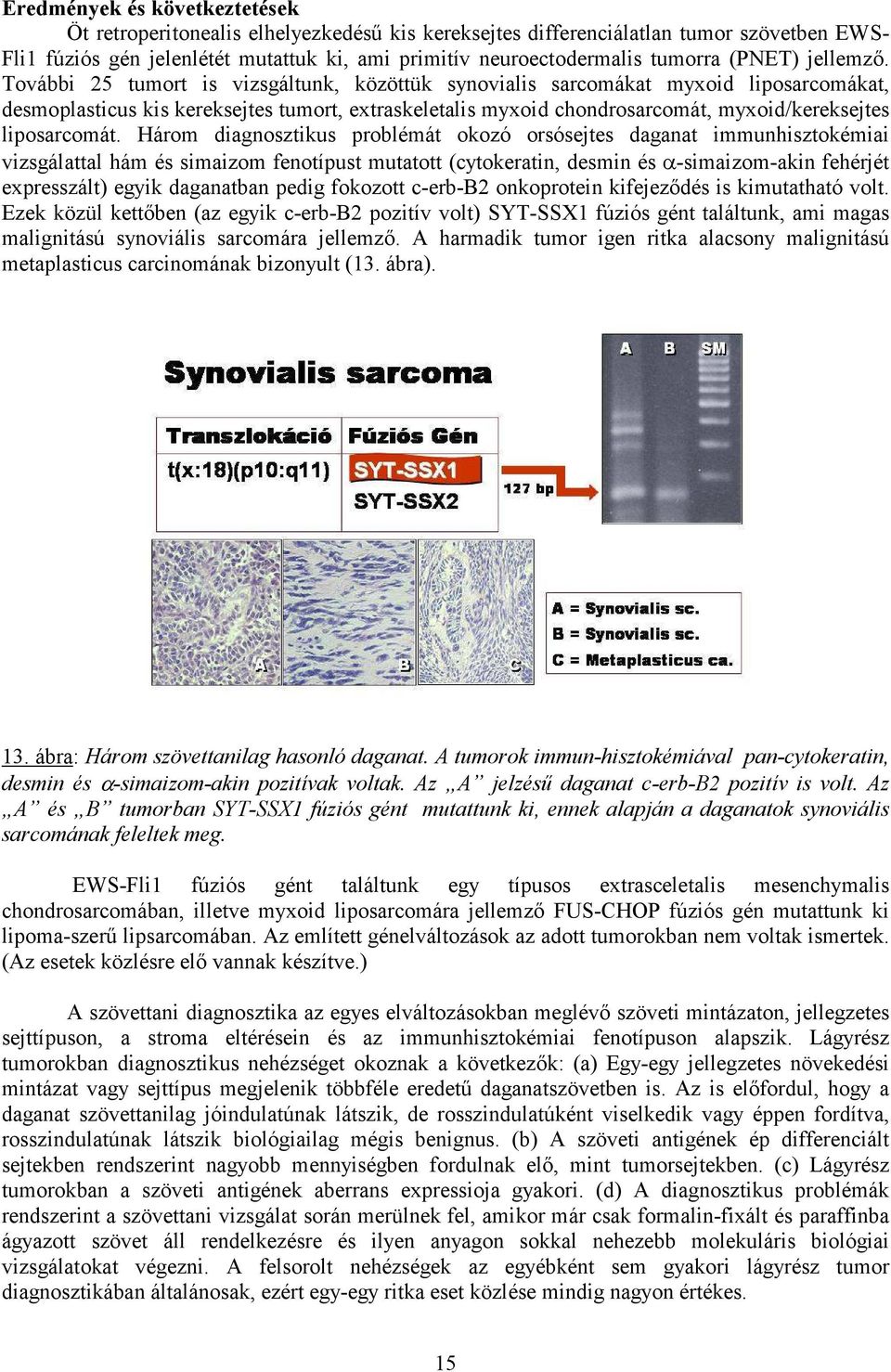 További 25 tumort is vizsgáltunk, közöttük synovialis sarcomákat myxoid liposarcomákat, desmoplasticus kis kereksejtes tumort, extraskeletalis myxoid chondrosarcomát, myxoid/kereksejtes liposarcomát.