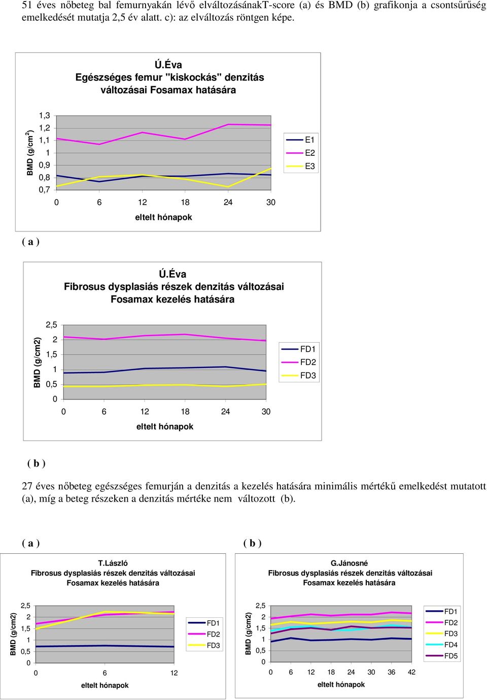 Éva Fibrosus dysplasiás részek denzitás változásai Fosamax kezelés hatására BMD (g/cm2) 2,5 2 1,5 1,5 FD1 FD2 FD3 6 12 18 24 3 eltelt hónapok ( b ) 27 éves nőbeteg egészséges femurján a denzitás a