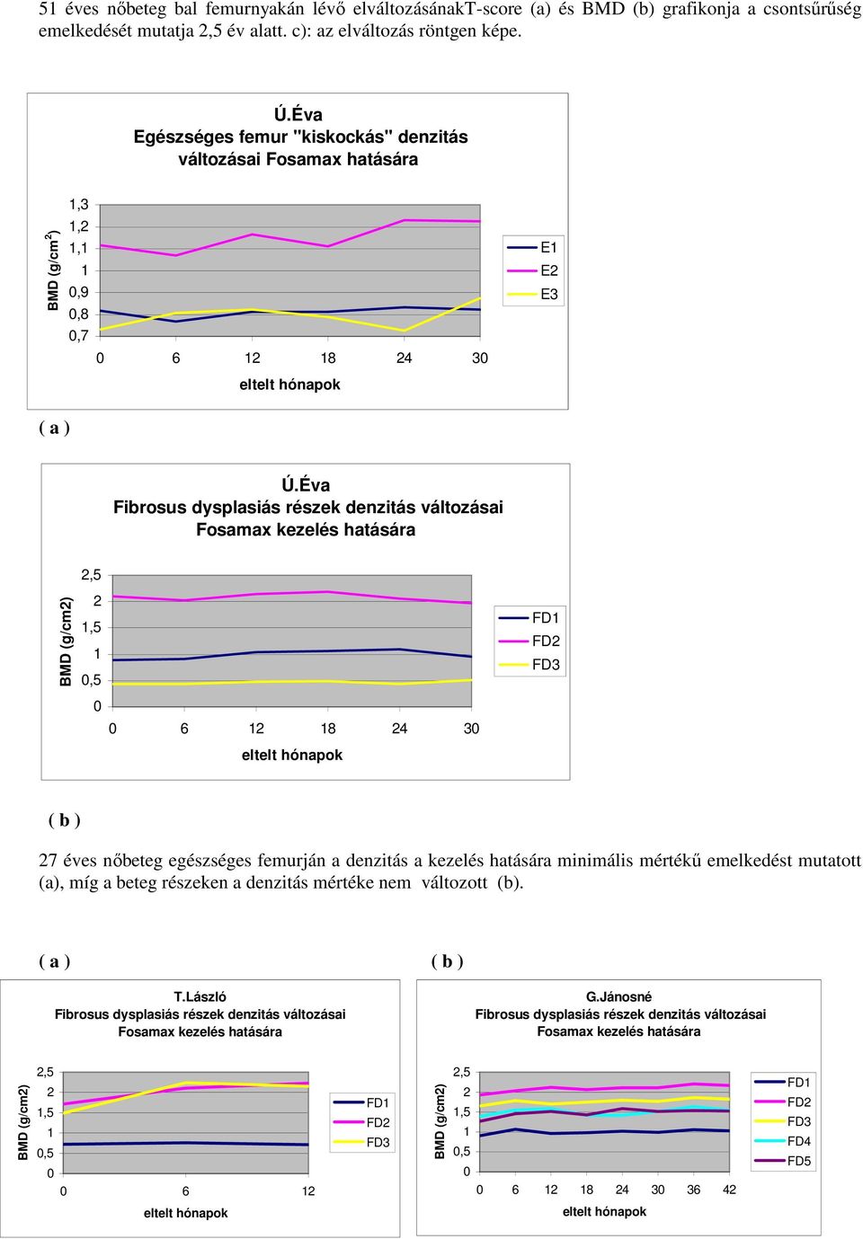 Éva Fibrosus dysplasiás részek denzitás változásai Fosamax kezelés hatására BMD (g/cm2) 2,5 2 1,5 1,5 FD1 FD2 FD3 6 12 18 24 3 eltelt hónapok ( b ) 27 éves nőbeteg egészséges femurján a denzitás a