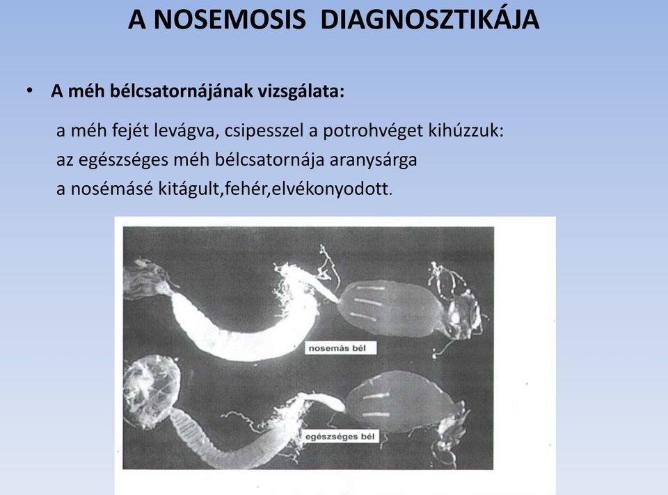 potrohvéget kihúzzuk: az egészséges méh