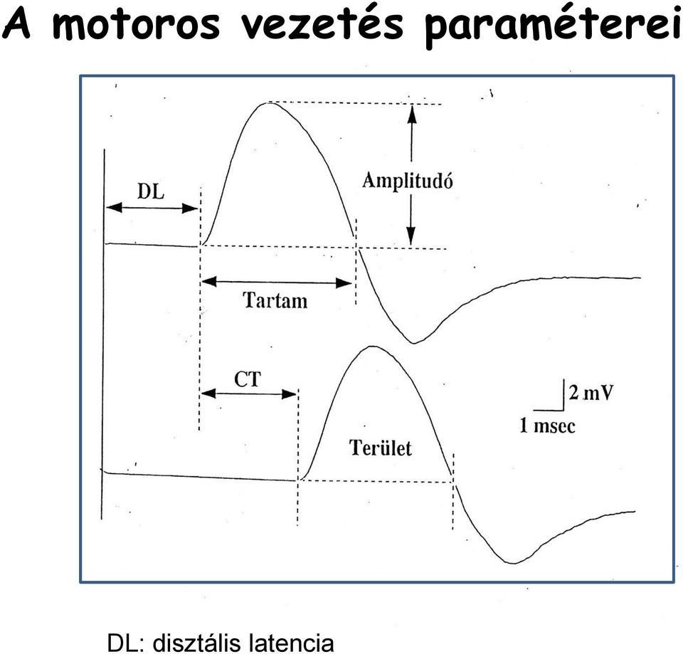 paraméterei