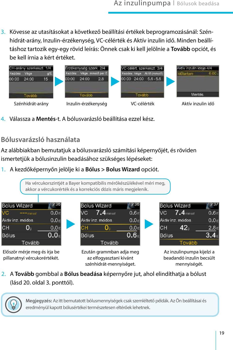 Válassza a Mentés-t. A bólusvarázsló beállítása ezzel kész.