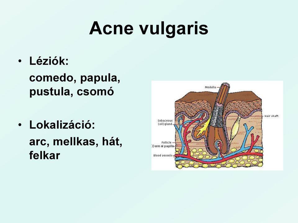 pustula, csomó